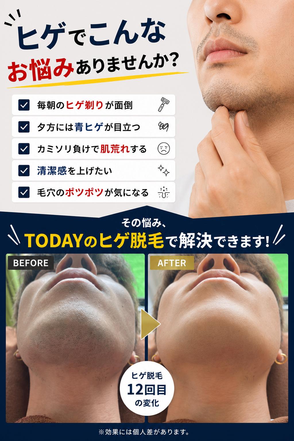 初回キャンペーン