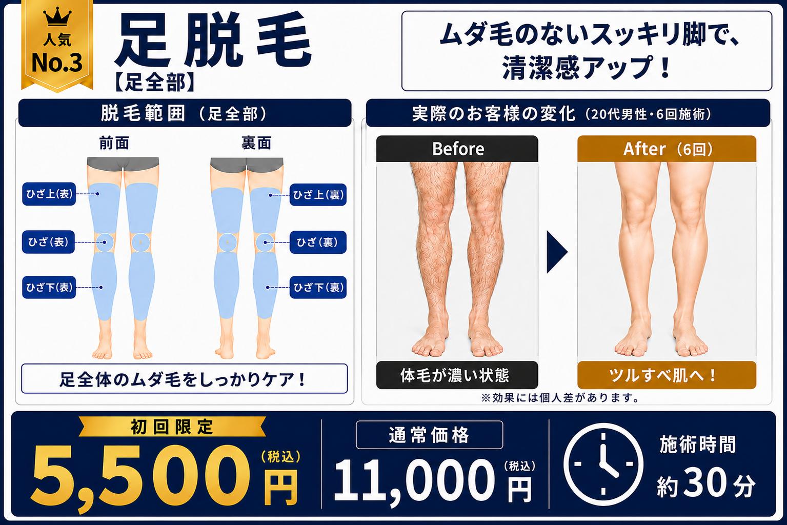 初回キャンペーン