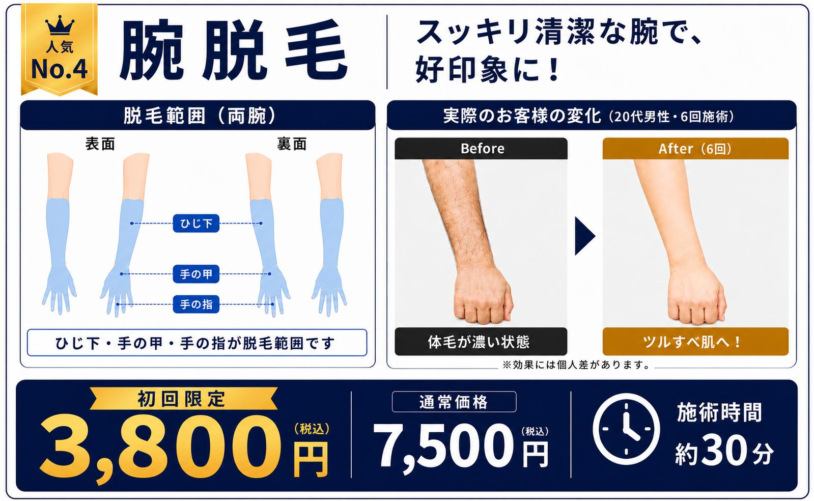 初回キャンペーン