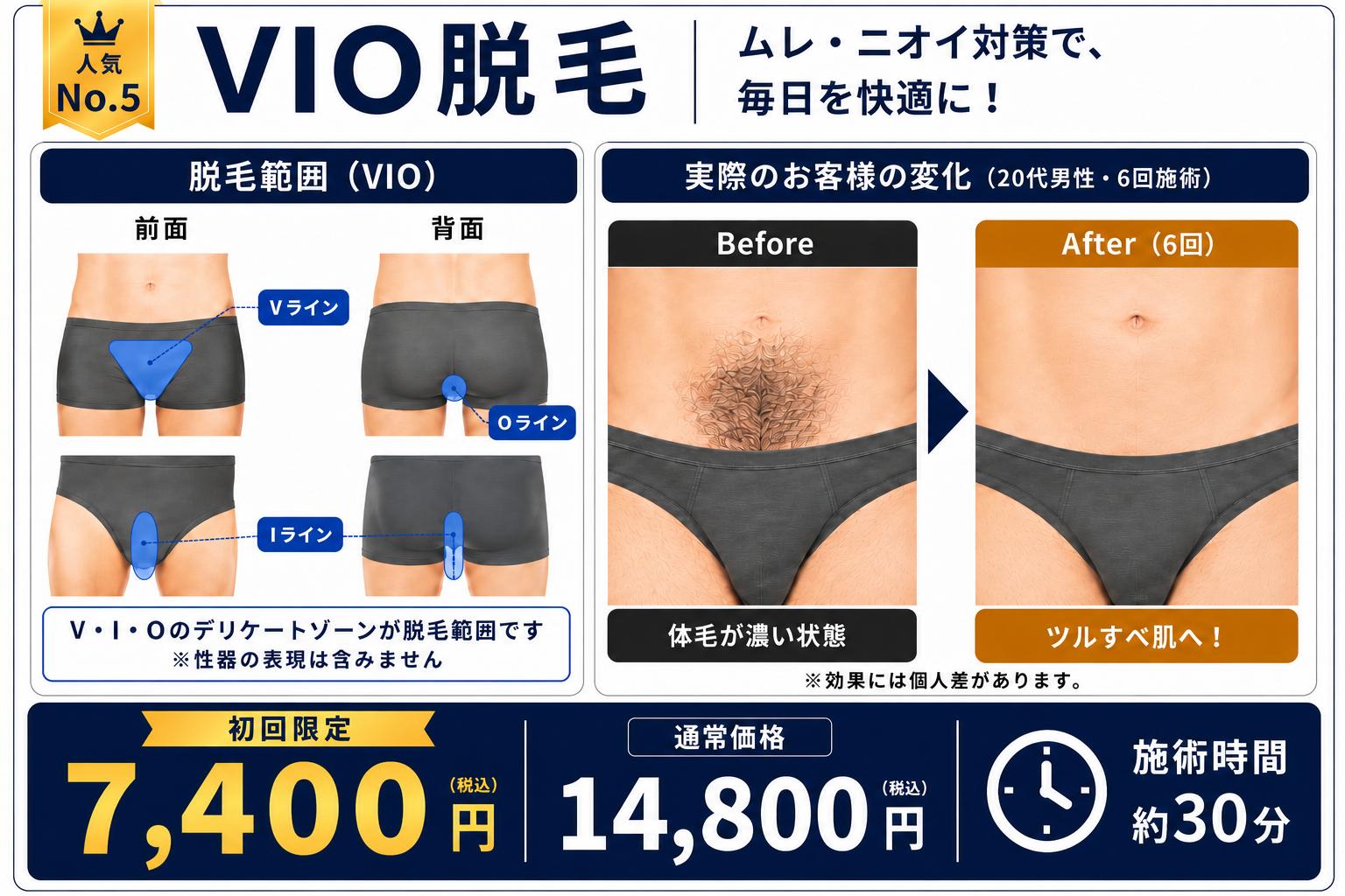 初回キャンペーン