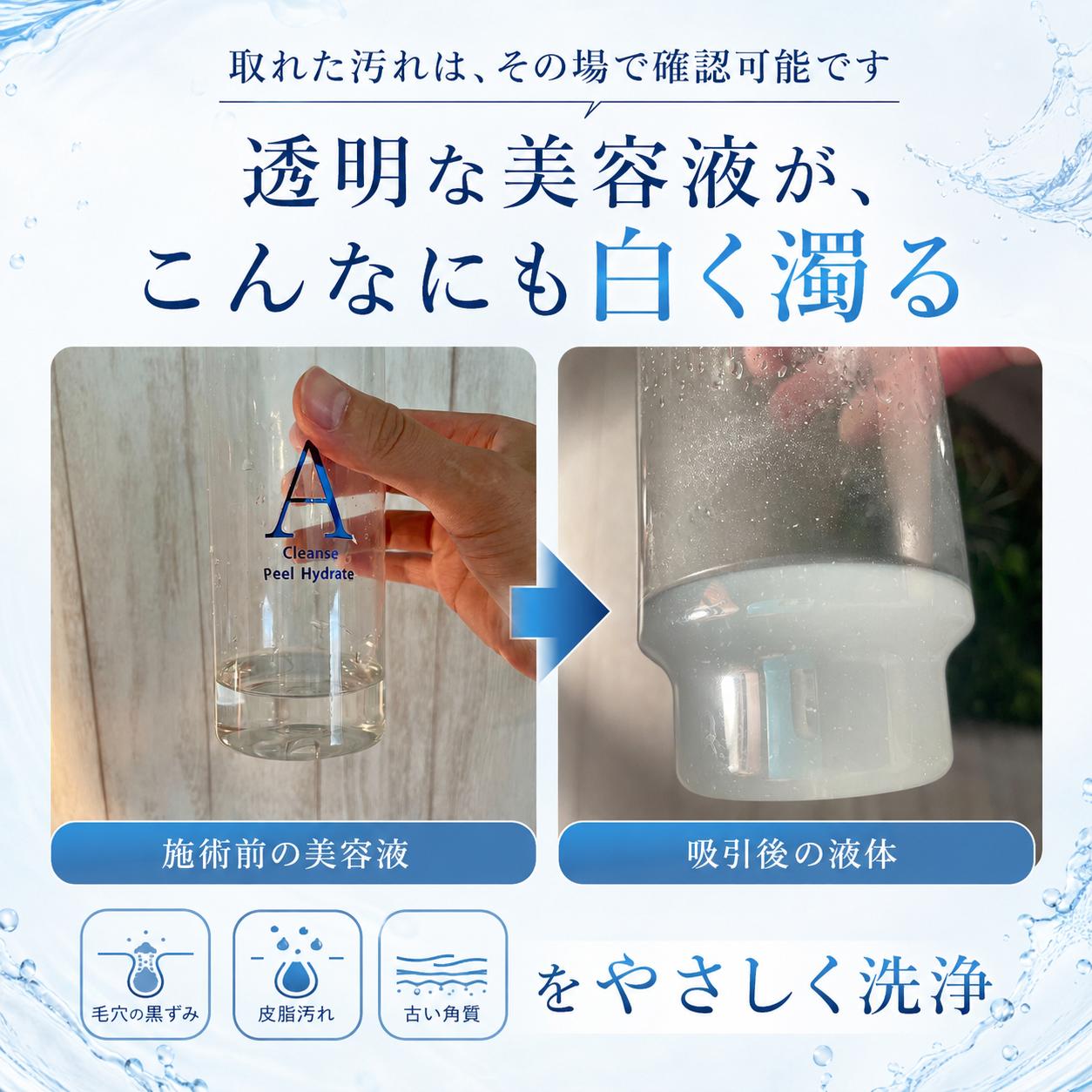 毛穴洗浄｜TODAY-滋賀県草津市の完全予約制メンズ脱毛サロン
