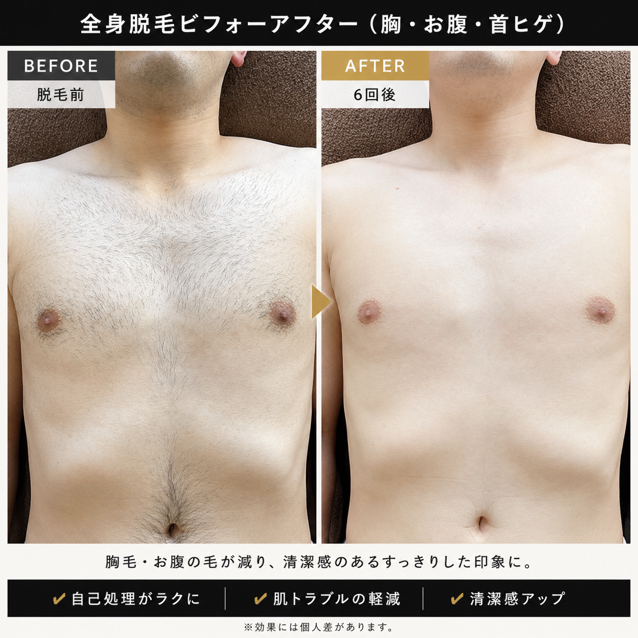 初回キャンペーン